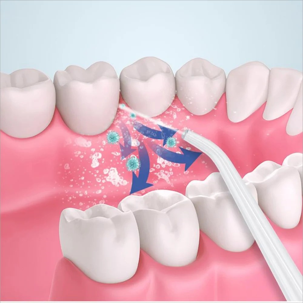 Hqd Portable Household Electric Tooth Washer Teeth Cleaning Oral Care No Harm to Teeth Dental Rechargeable Teeth Whitening - Slobuy