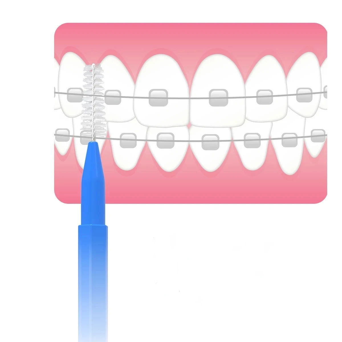 30/150Pcs Interdental Brushes Health Care Tooth Escova Interdental Cleaners Orthodontic Dental Teeth Brush Oral Hygiene Tool - Slobuy