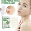 36/180Pc Acne Pimple Patch Sticker Waterproof Acne Treatment Pimple Remover Tool Blemish Spot Facial Mask SkinCare Hidden Pimple - Slobuy