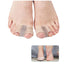 1PCS Toe Separator Hallux Valgus Bunion Corrector Orthotics Feet Bone Thumb Adjuster Correction Pedicure Feet Straightener - Slobuy