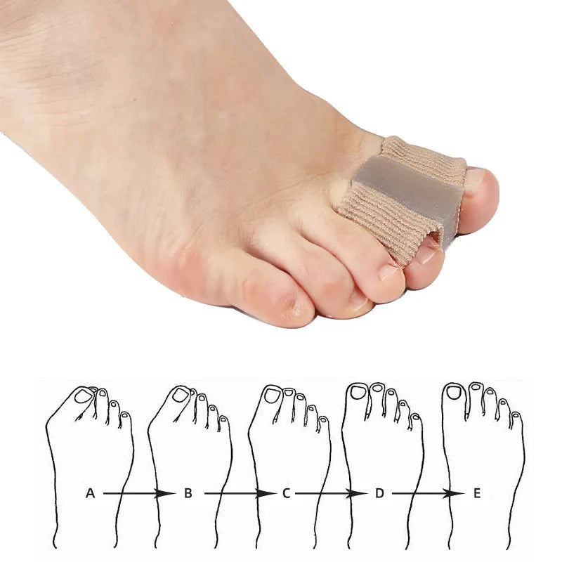 1PCS Toe Separator Hallux Valgus Bunion Corrector Orthotics Feet Bone Thumb Adjuster Correction Pedicure Feet Straightener - Slobuy