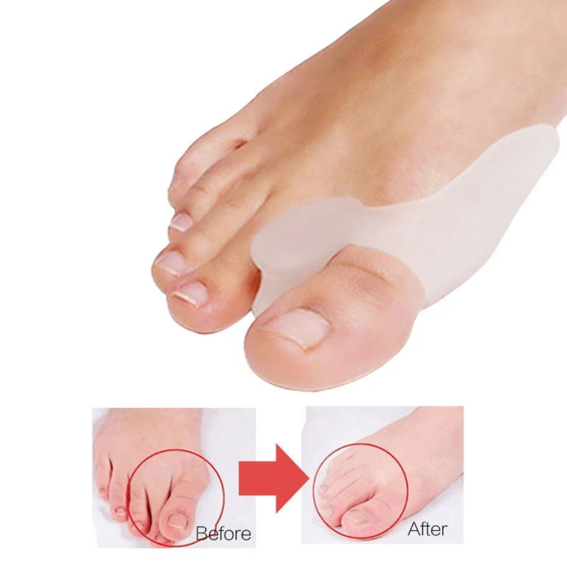 1Pair Silicone Toes Separator Bunion Bone Ectropion Adjuster Toes Outer Appliance Foot Care Tools Hallux Valgus Corrector - Slobuy