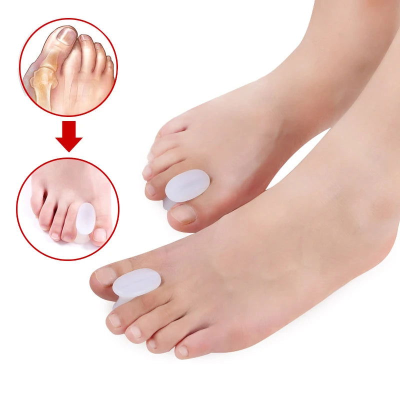 1Pair Silicone Toes Separator Bunion Bone Ectropion Adjuster Toes Outer Appliance Foot Care Tools Hallux Valgus Corrector - Slobuy