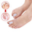 1Pair Silicone Toes Separator Bunion Bone Ectropion Adjuster Toes Outer Appliance Foot Care Tools Hallux Valgus Corrector - Slobuy