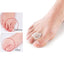 1Pair Silicone Toes Separator Bunion Bone Ectropion Adjuster Toes Outer Appliance Foot Care Tools Hallux Valgus Corrector - Slobuy