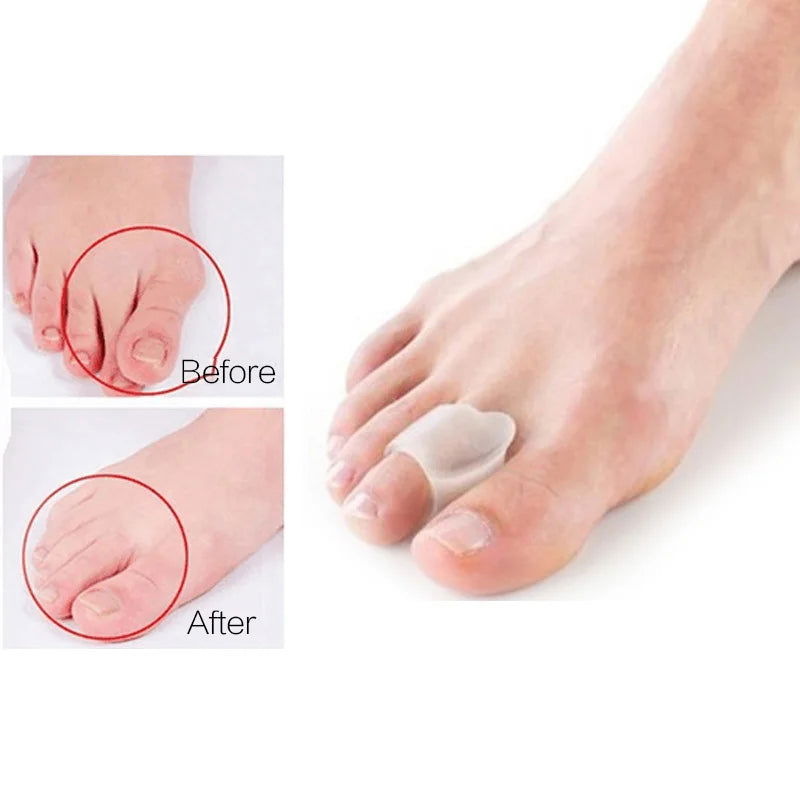1Pair Silicone Toes Separator Bunion Bone Ectropion Adjuster Toes Outer Appliance Foot Care Tools Hallux Valgus Corrector - Slobuy