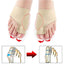 1Pair Toe Separator Hallux Valgus Bunion Corrector Hammer Toe Straightener Foot Pain Relief Orthopedic Pedicure Tools Foot Care - Slobuy