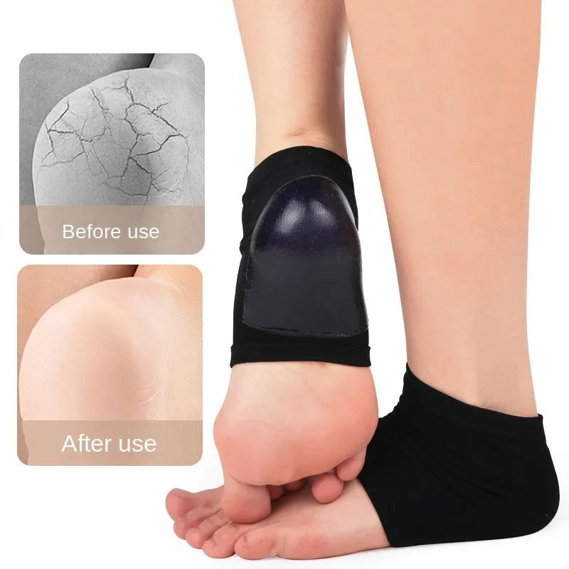 2PCS Gel Moisturizing Heel Socks Spa Sock For Foot Care Gel Heel Socks For Dry Cracked Dry Feet Skin Gel Heel Repair Socks Tools - Slobuy