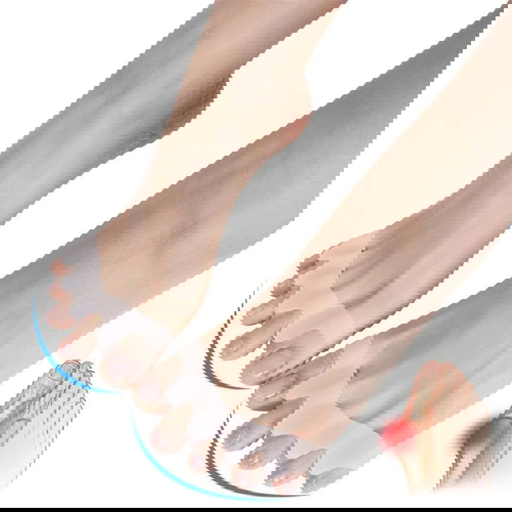 2pcs=1pair New Protective Toes Separator Suitable Bunion Corrector Material Soft Gel Straightener Spacers Stretchers Care Tool - Slobuy