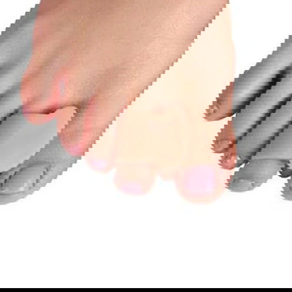 2pcs=1pair New Protective Toes Separator Suitable Bunion Corrector Material Soft Gel Straightener Spacers Stretchers Care Tool - Slobuy
