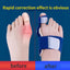 1PC/2pcs Big Bone Toe Bunion Splint Straightener Corrector Foot Pain Relief Hallux Valgus Feet Care Protector Foot Care Tools - Slobuy