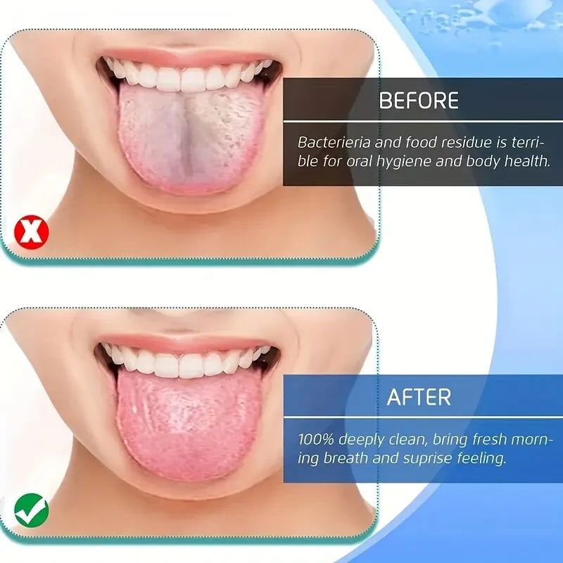 3 Colors Stainless Steel Tongue Scraper U-shaped Metal Fresh Breath Cleaning Coated Tongue Toothbrush Oral Hygiene Care Tools - Slobuy