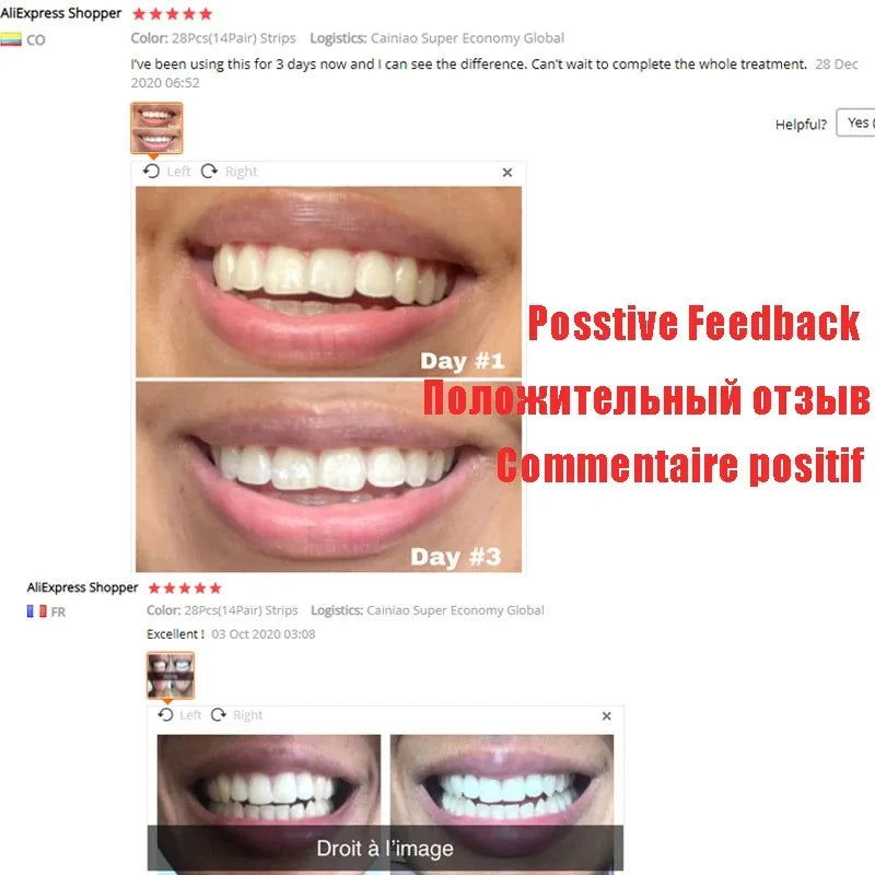 5D Gel Teeth Whitening Strips White Tooth Dental kit Oral Hygiene Care Strip for false Teeth Veneers Dentist Seks Whiten Gel - Slobuy