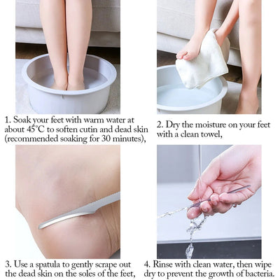 Pedicure Knife Tools for Feet Stainless Steel Foot Scrubber Dead Skin Remover 1/2/5Pcs Foot Scraper Knife Scraping Manicure Tool - Slobuy