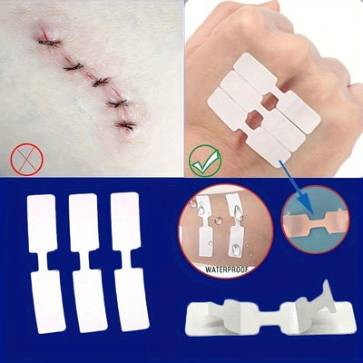 5Pcs Outdoor Wound Adhesive Tape Disposable First Aid Wound Suture Patch Wound Band Aid - Slobuy