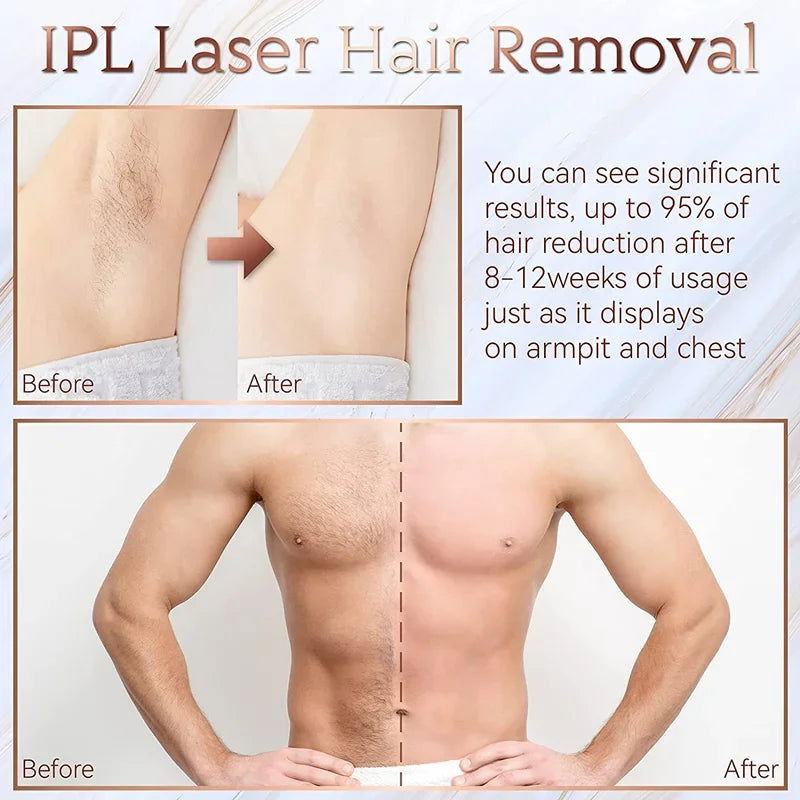 999999 Flashes IPL Laser Epilator for Women Home Use Devices Hair Removal Painless Electric Epilator Bikini - Slobuy