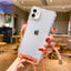 Crossbody Necklace Cord Lanyard Transparent Hard Phone Case For iPhone 15 14 13 12 11 Pro Max XS XR X 8 7 Plus Clear Soft Cover - Slobuy