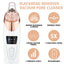Electric Blackhead Remover Vacuum Acne Cleaner Black Spots Removal Facial Deep Cleansing Pore Cleaner Machine Skin Care Tools - Slobuy