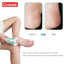 Electric Foot File Pedicure Tools Feet Callus Removers Rechargeable Foot Scrubber Feet Care for Dead, Hard Cracked Dry Skin - Slobuy