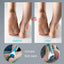 Foot Care Tool Electric Foot File Foot Callouses Dead Skin Remover Shaver Remove Dry Dead Hard Cracked Skin Safe and Painless - Slobuy