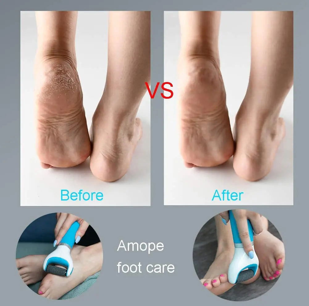 Foot Care Tool Electric Foot File Foot Callouses Dead Skin Remover Shaver Remove Dry Dead Hard Cracked Skin Safe and Painless - Slobuy