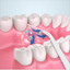 Hqd Portable Household Electric Tooth Washer Teeth Cleaning Oral Care No Harm to Teeth Dental Rechargeable Teeth Whitening - Slobuy