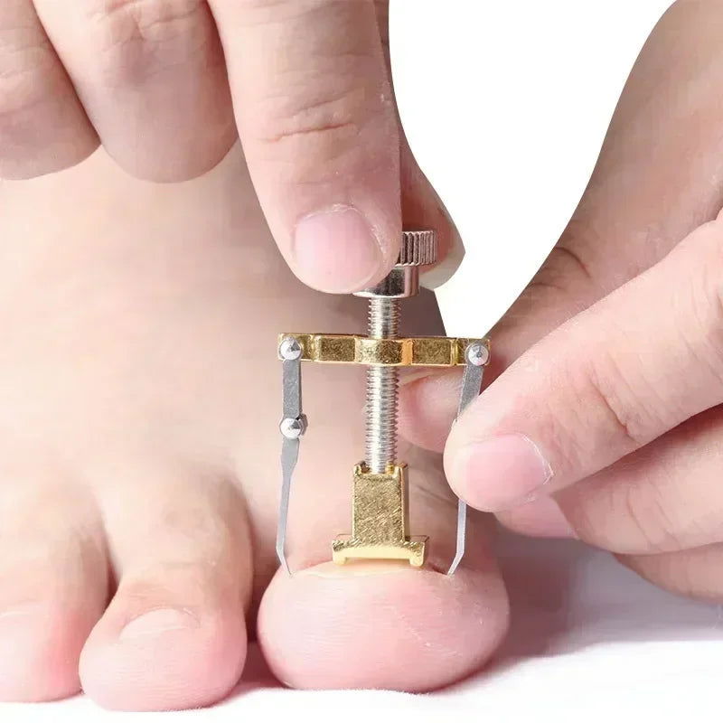 Ingrown Toenail Corrector Straightening Clip Pedicure Foot Nail Care Tools Stainless Steel Pedicure Treatment Onyxis Correction - Slobuy