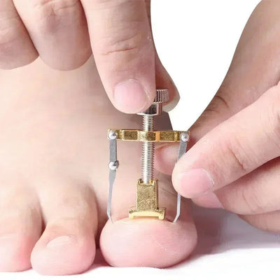 Ingrown Toenail Corrector Straightening Clip Pedicure Foot Nail Care Tools Stainless Steel Pedicure Treatment Onyxis Correction - Slobuy