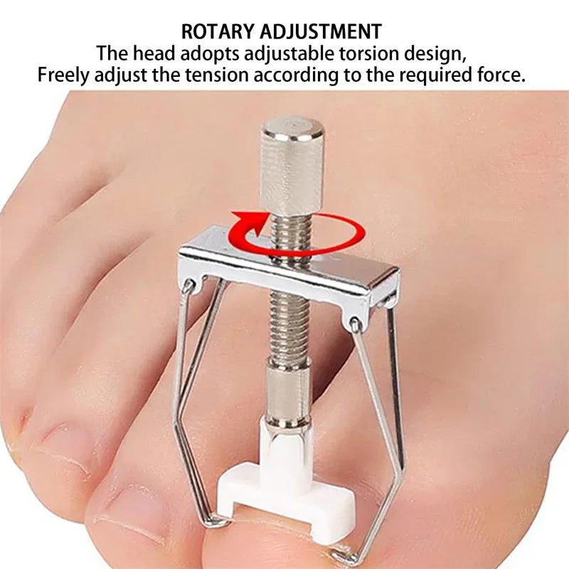 Ingrown Toenail Corrector Straightening Clip Pedicure Foot Nail Care Tools Stainless Steel Pedicure Treatment Onyxis Correction - Slobuy