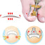 Ingrown Toenail Tools Set Ingrown Toenail Correction Patch Stickers Corrector Pedicure Tool Ingrown Toe Nail Treatment Foot Care - Slobuy