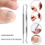 Ingrown Toenail Tools Set Ingrown Toenail Correction Patch Stickers Corrector Pedicure Tool Ingrown Toe Nail Treatment Foot Care - Slobuy
