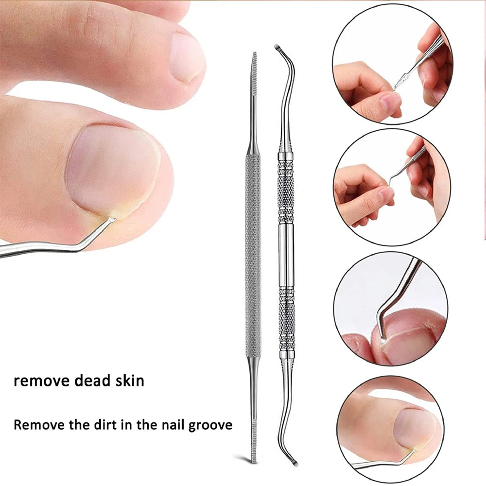 Ingrown Toenail Tools Set Ingrown Toenail Correction Patch Stickers Corrector Pedicure Tool Ingrown Toe Nail Treatment Foot Care - Slobuy