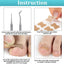 Ingrown Toenail Tools Set Ingrown Toenail Correction Patch Stickers Corrector Pedicure Tool Ingrown Toe Nail Treatment Foot Care - Slobuy