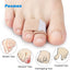 Pexmen 1/2/5/10Pcs Hammer Toe Straightener Toe Splints Cushions Bandages for Correcting Crooked & Overlapping Toes Protector - Slobuy