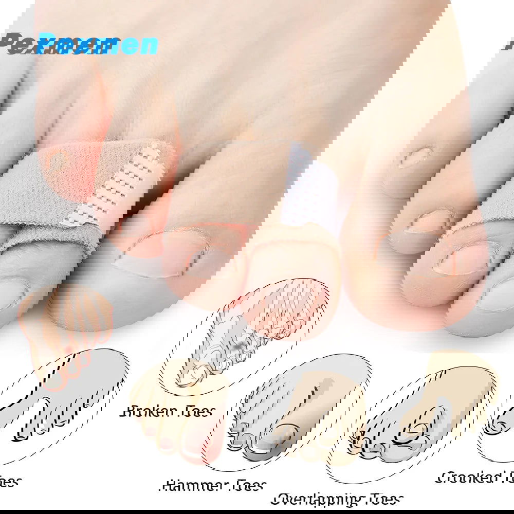 Pexmen 1/2/5/10Pcs Hammer Toe Straightener Toe Splints Cushions Bandages for Correcting Crooked & Overlapping Toes Protector - Slobuy