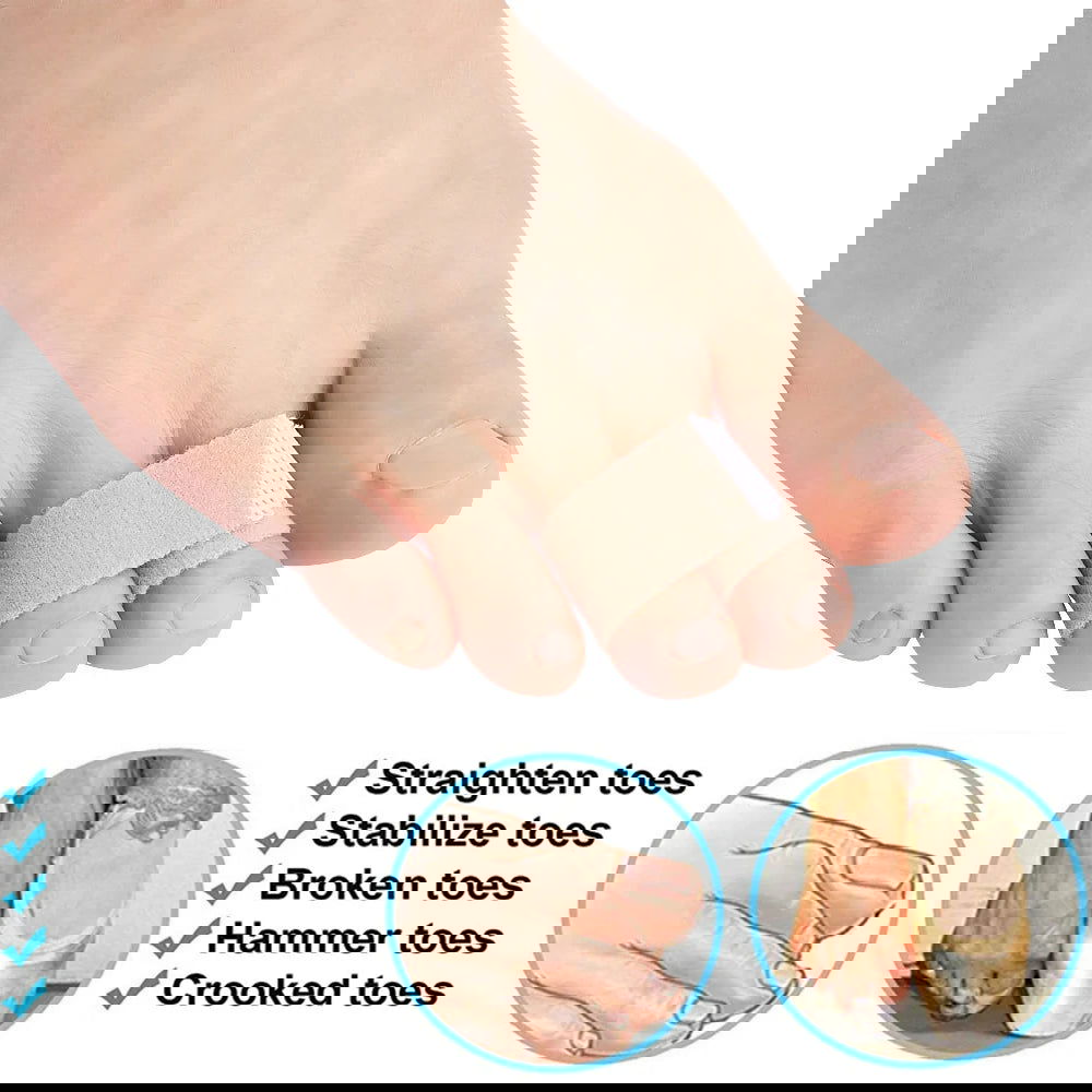 Pexmen 1/2/5/10Pcs Hammer Toe Straightener Toe Splints Cushions Bandages for Correcting Crooked & Overlapping Toes Protector - Slobuy