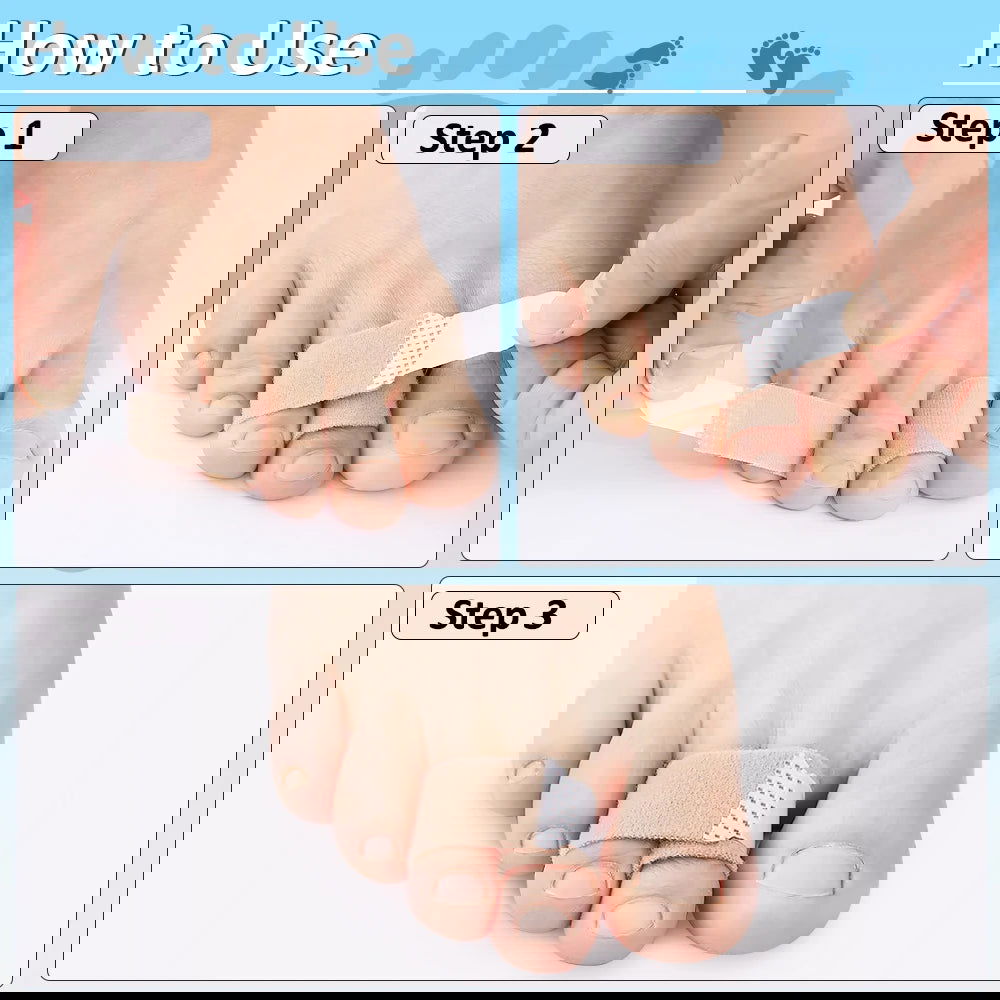 Pexmen 1/2/5/10Pcs Hammer Toe Straightener Toe Splints Cushions Bandages for Correcting Crooked & Overlapping Toes Protector - Slobuy