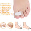 Pexmen 1/2/5/10Pcs Hammer Toe Straightener Toe Splints Cushions Bandages for Correcting Crooked & Overlapping Toes Protector - Slobuy