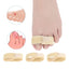 Pexmen 1/2/5/10Pcs Hammer Toe Straightener Toe Splints Cushions Bandages for Correcting Crooked & Overlapping Toes Protector - Slobuy