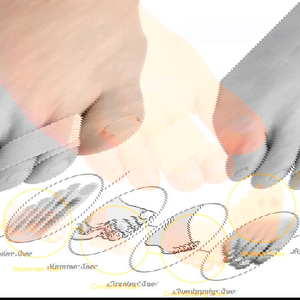 Pexmen 1/2/5/10Pcs Hammer Toe Straightener Toe Splints Cushions Bandages for Correcting Crooked & Overlapping Toes Protector - Slobuy