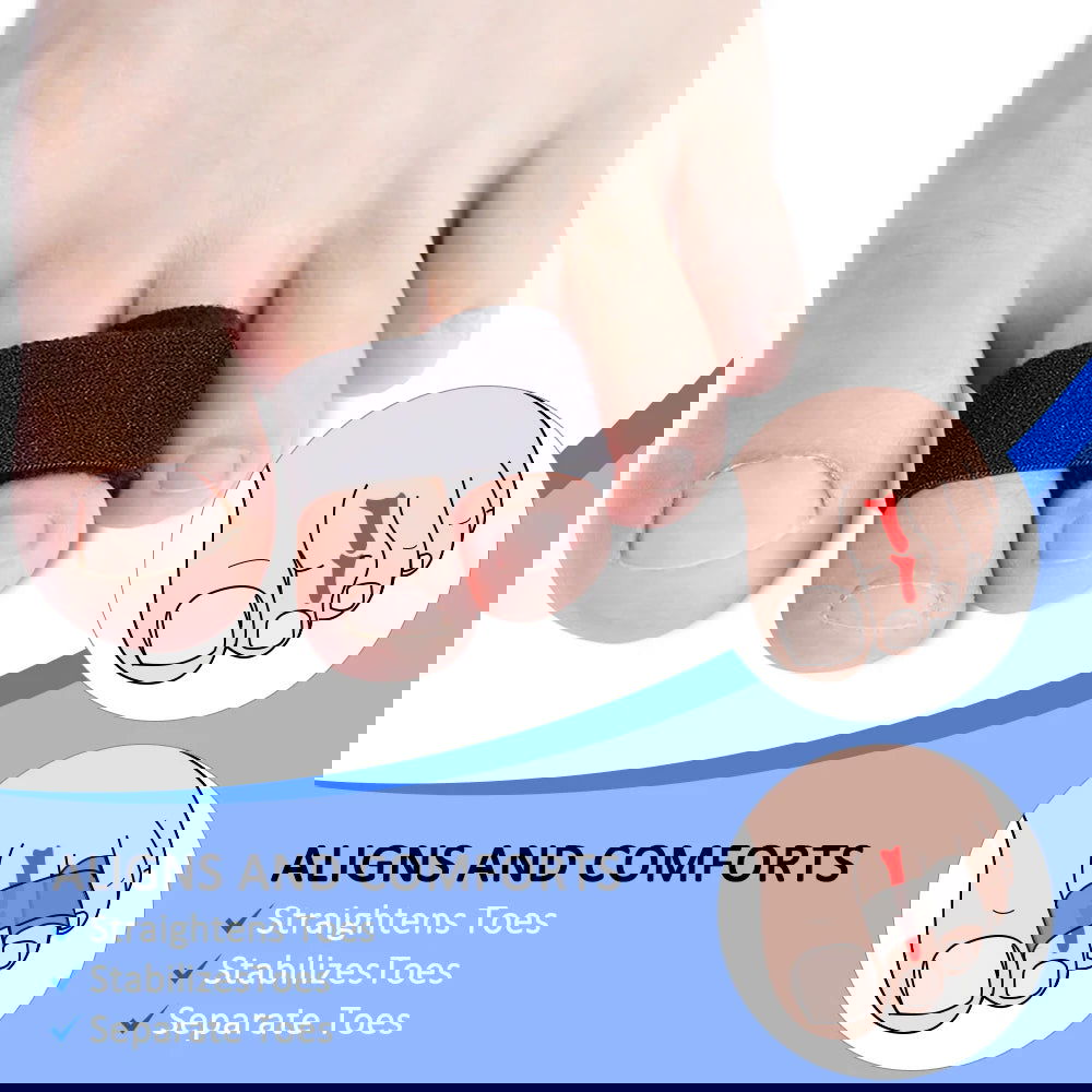 Pexmen 1/2/5/10Pcs Hammer Toe Straightener Toe Splints Cushions Bandages for Correcting Crooked & Overlapping Toes Protector - Slobuy