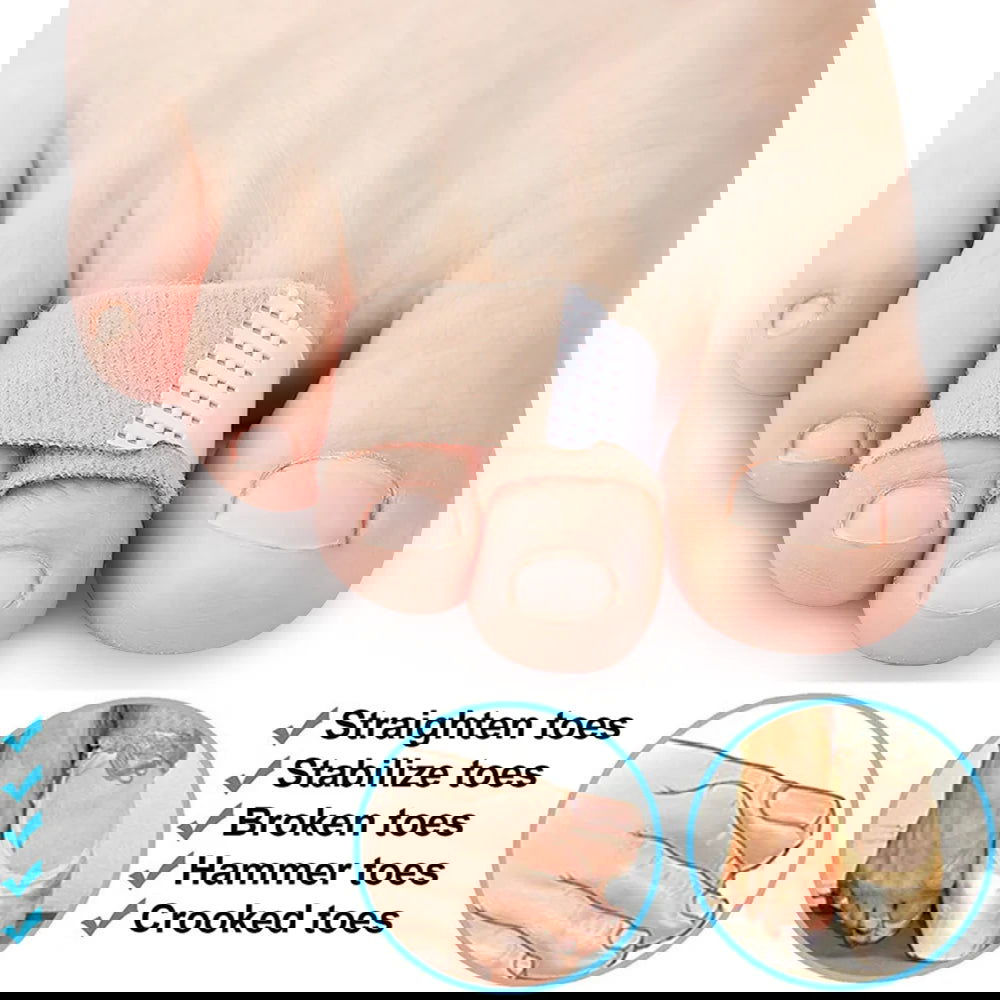 Pexmen 1/2/5/10Pcs Hammer Toe Straightener Toe Splints Cushions Bandages for Correcting Crooked & Overlapping Toes Protector - Slobuy