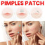 Repair Acne Patch Facial Skin Care Fade Blemishes Pimple Marks Closed Acne Blemishes Cover Acne Pimple Repair Patch - Slobuy