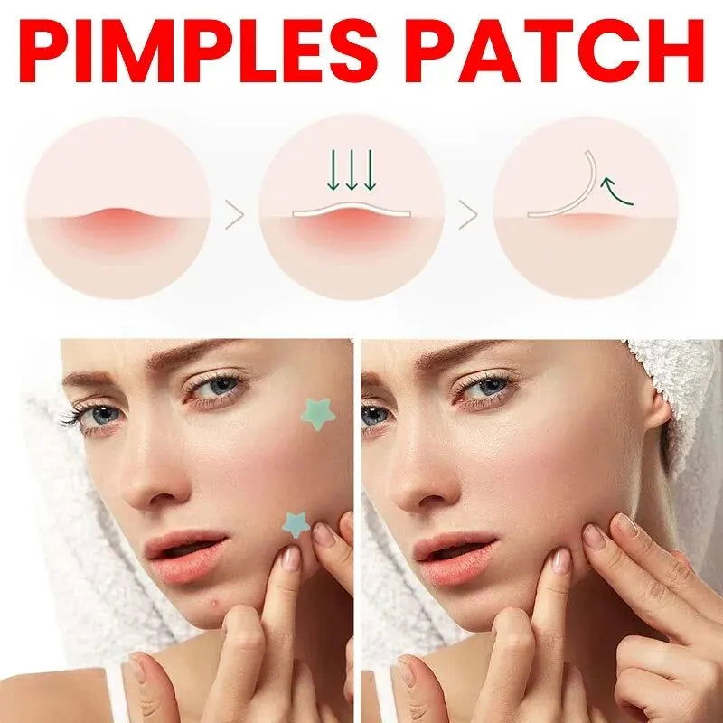 Repair Acne Patch Facial Skin Care Fade Blemishes Pimple Marks Closed Acne Blemishes Cover Acne Pimple Repair Patch - Slobuy