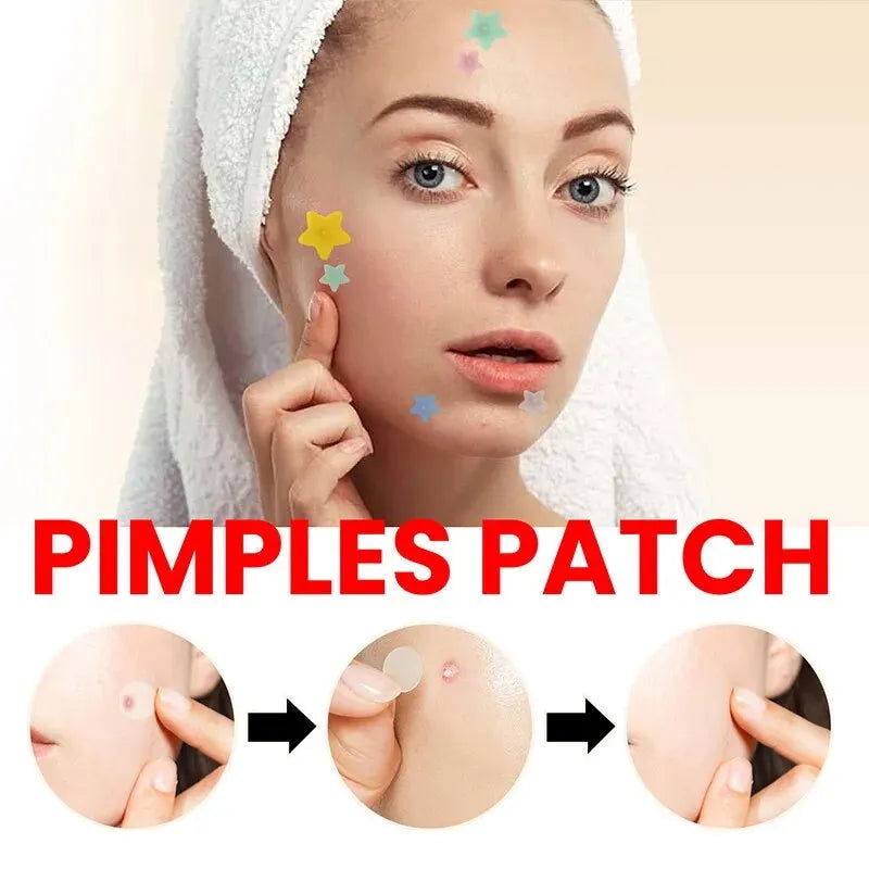 Repair Acne Patch Facial Skin Care Fade Blemishes Pimple Marks Closed Acne Blemishes Cover Acne Pimple Repair Patch - Slobuy
