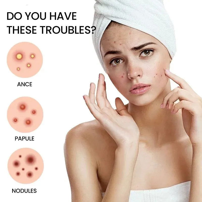 Repair Acne Patch Facial Skin Care Fade Blemishes Pimple Marks Closed Acne Blemishes Cover Acne Pimple Repair Patch - Slobuy